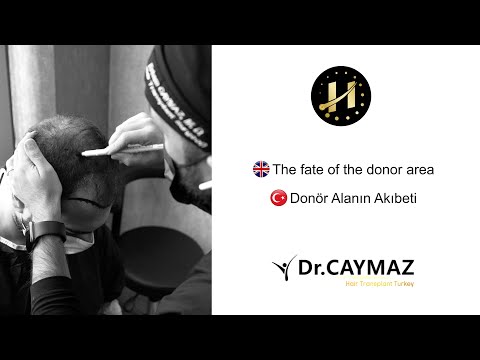 The Fate of the Donor Area