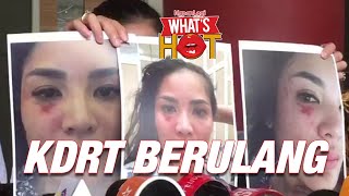 Nindy Ayunda Akhirnya Buka Suara, Bawa Bukti KDRT