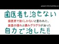 歯医者で抜くしかないと言われたが歯と歯茎を強くする方法を実行したら歯茎の腫れと膿みグラグラが治った！
