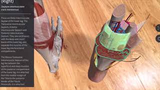 Shin Splints Compartment Syndrome