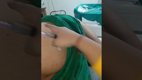 intramuscular injection video || avildexa injection || day-1 se day- 9 tak alergy injection video