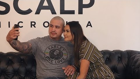 REAL Scalp Micropigmentation Review | Scalp Micro USA