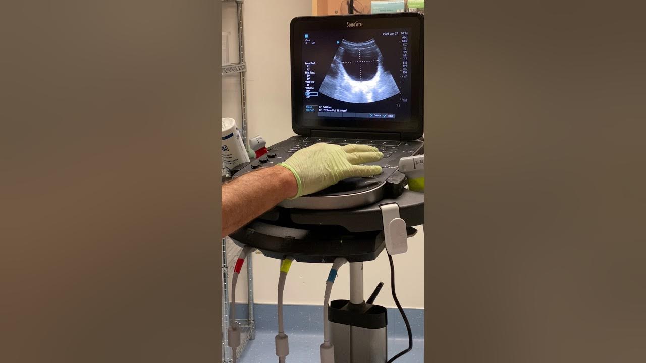 bladder-scan-procedure-youtube