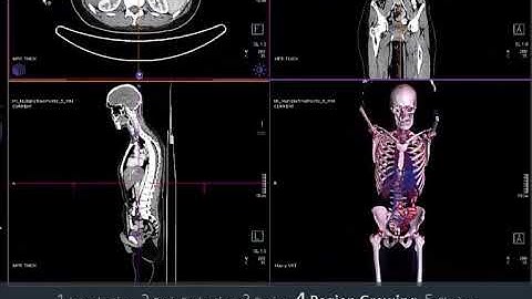 syngo via VB10 MM Reading in Oncology