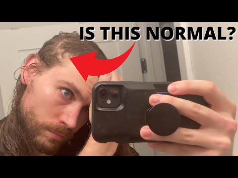 5 NORMAL Things