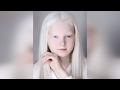 Чеченская школьница-альбинос удивила людей красотой | Chechen girlalbino was surprised by the beauty