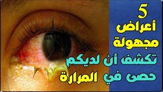 5 أعراض مجهولة تكشف أن لديكم حصى في المرارة تعرفوا عليها