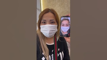 CẮT MÍ + MỞ GÓC MẮT TRONG CHO CHỊ KHÁCH VIỆT KIỀU CANADA🥰 #beauty #pttm #nangmui #catmi #xuhuong