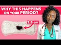  period poop  other weird things that happen during your period