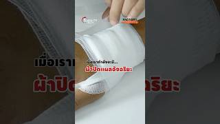ผาปดแผลอจฉรยะ แผลหายเรวขน 25%