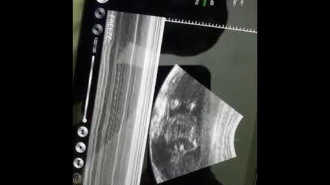 Konted C10 3rd Generation wireless ultrasound probe