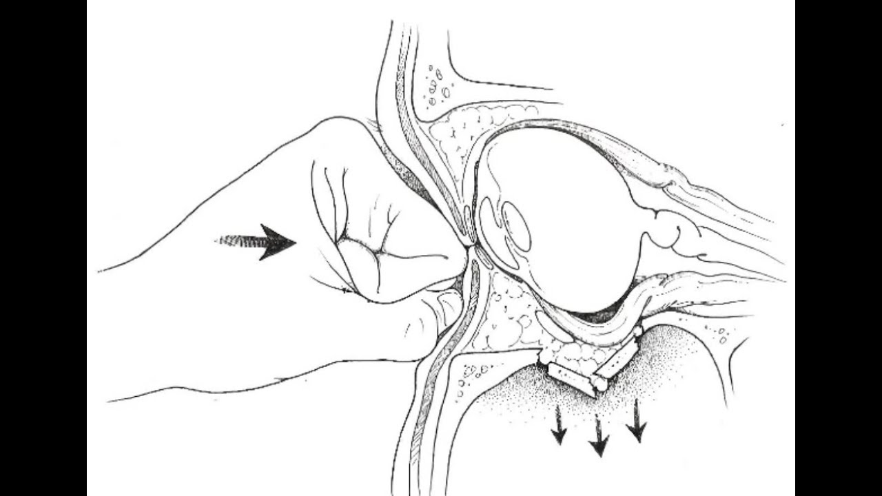 Eye Socket Hentai