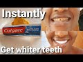 How to whiten your teeth instantly, life hacking magical home remedies