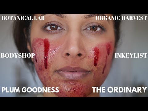 TOP  AFFORDABLE SKINCARE THAT WORKS LIKE LUXURY | BEFORE/AFTER ACNE RESULTS| BEST OF THE ORDINARY