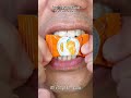 Satisfying Chewing ASMR #Compilation #ASMR #DoctorTristanPeh