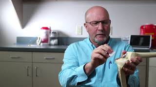 Partial Knee Replacement Explained by Dr. Martin Redish