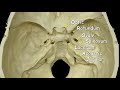 Cranial Foramina | Mnemonic Phrase