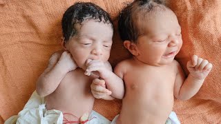 Fraternal Twins Newborn babies just after birth || one is soothing himself with thumb sucking ❤️