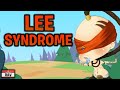 Lee Sin Syndrome | The Reality of Having a Lee Sin on Your Team
