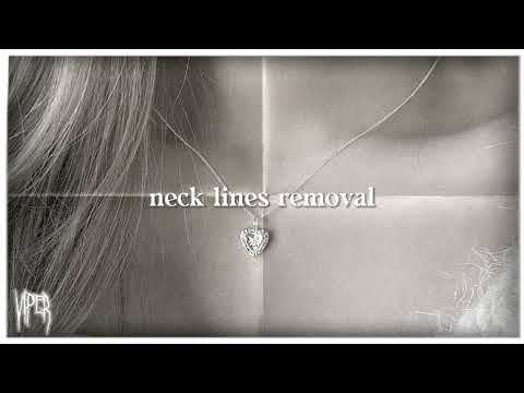 Neck Lines Removal