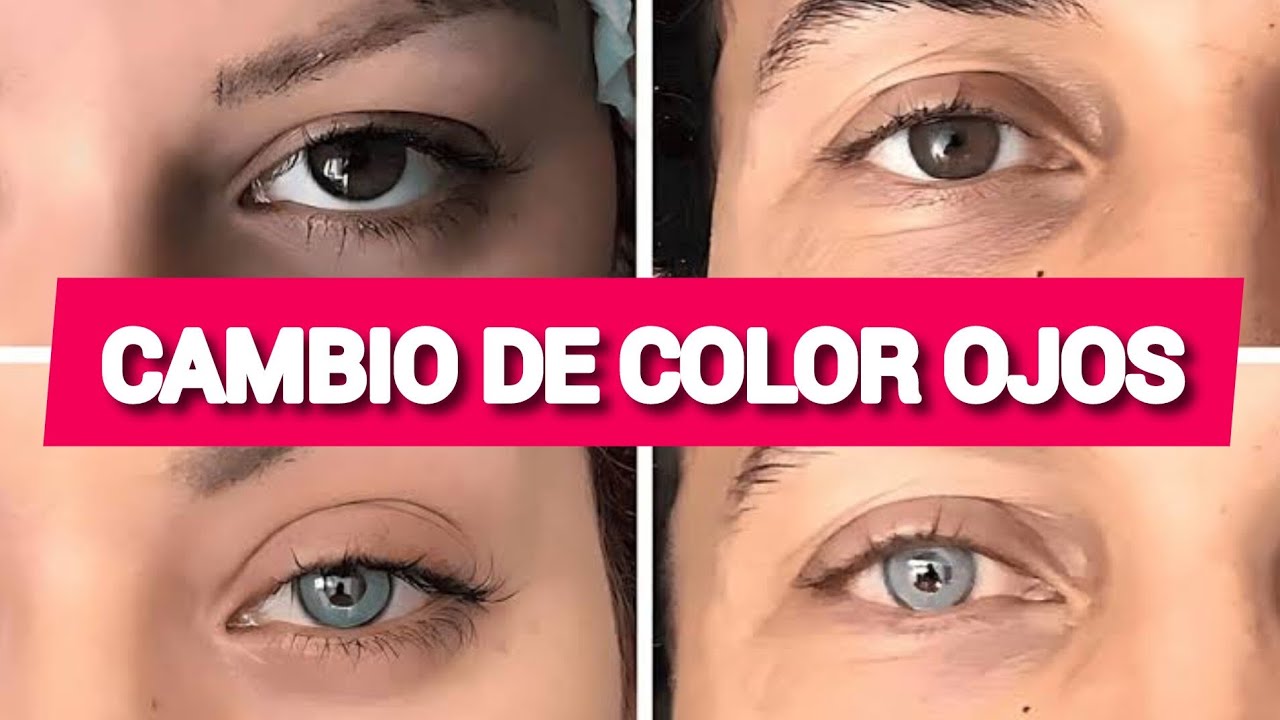 La Nueva Cirugía Cambio de Color De Ojos | VÍDEO - YouTube