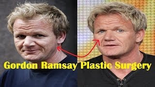 Gordon Ramsay Plastic Surgery Before and After