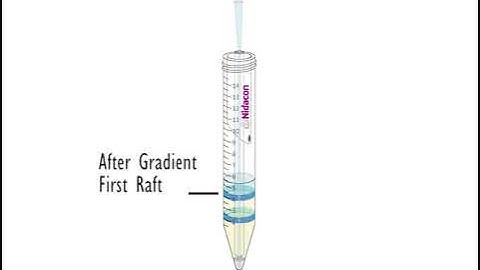 Before&After Density Gradient PureSperm