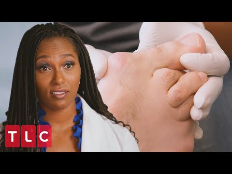 A Very Unique Foot | My Feet Are Killing Me