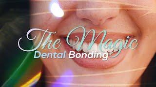 The Magic of Dental Bonding - A Quick Guide