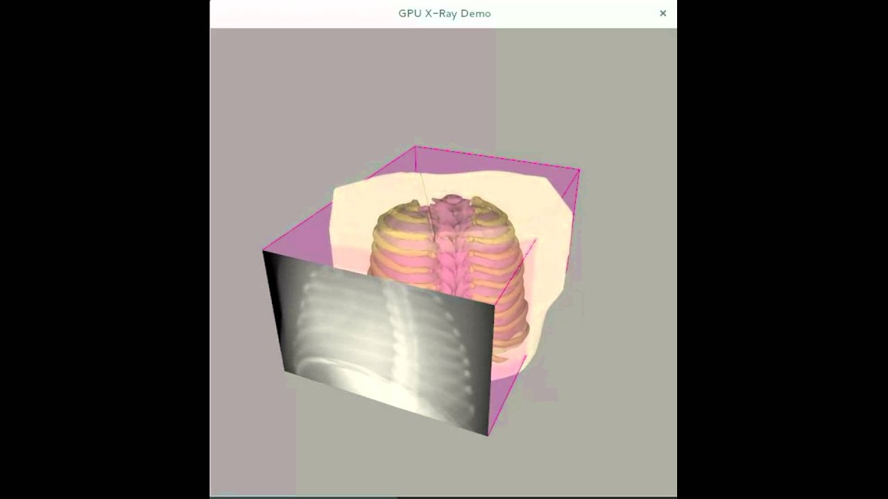 X-ray simulation based on anatomical data in OpenGL using gVirtualXRay ...
