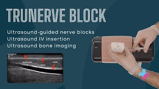 TruNerve Block | Ultrasound-Guided Regional Anesthesia &amp; IV Cannulation Trainer by TruCorp