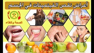 أعراض نقص الفيتامينات