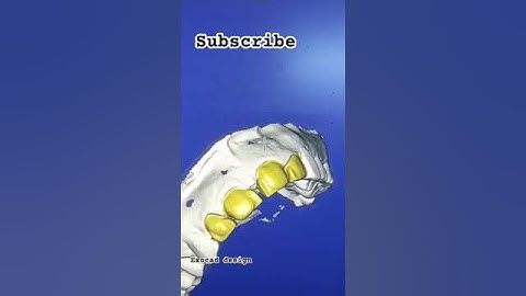 Exocad scanning design cuping #music #song #dental #dentallaboratory #dentallab #exocad #3dprinting