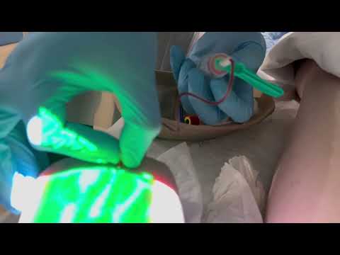 Vein finder ￼