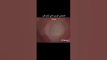 عندما أراد اكاي أن يريح قلبي وقلب هيبارا اكاي المحقق كونان هيبارا اكسبلور لايك 