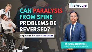 Can Paralysis from Spine Problems Be Reversed? | Spine Specialist Explains | Dr. Samarth Mittal