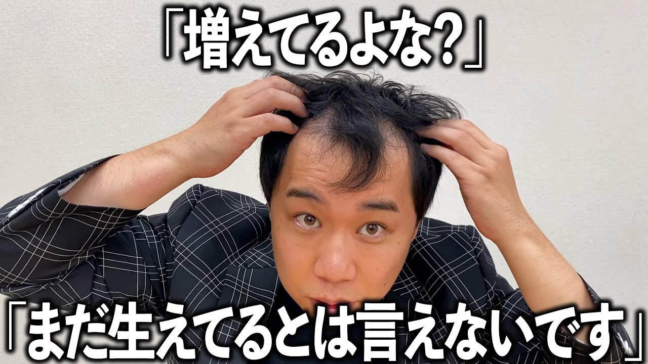 霜降り せいや はげ