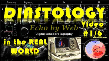 Echocardiographic analysis of LV diastolic function_Video 1