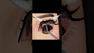 Asmr removing contact lenses from infected eye #asmr #asmranimation