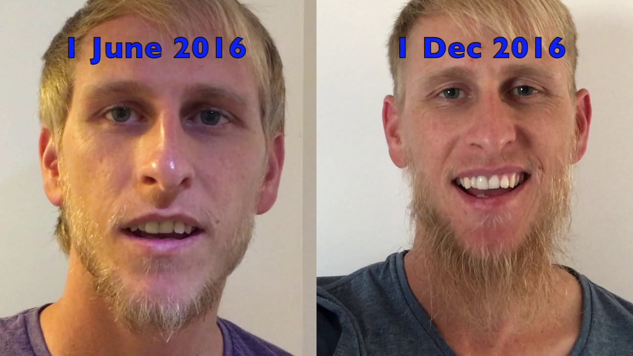 Can A Blonde Guy Grow A Beard Youtube