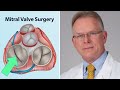 Mitral valve surgery what should patients know interview with dr vaughn starnes