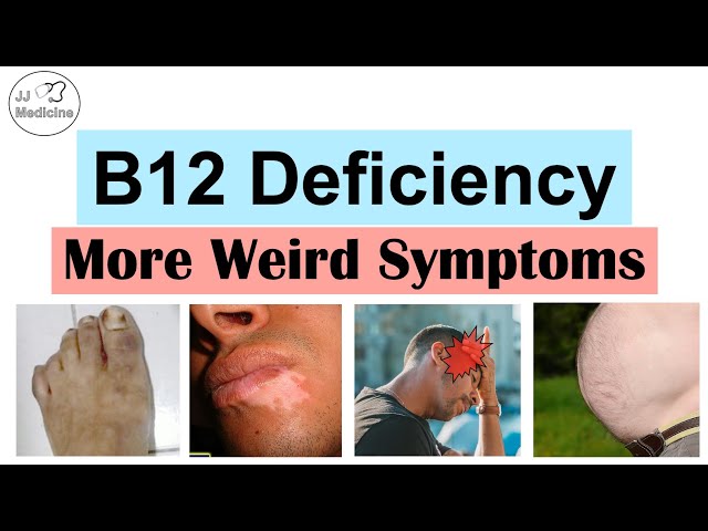 16 Benefits Of Vitamin B12, Dosage, And Side Effects