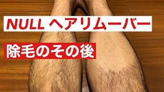 NULLヘアリムーバー　除毛のその後