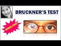 Bruckners test english  squint simplified  paediatric ophthalmology