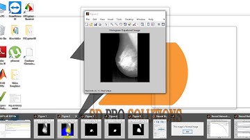 Breast cancer detection using matlab code|final year ece projects consultants at Bangalore
