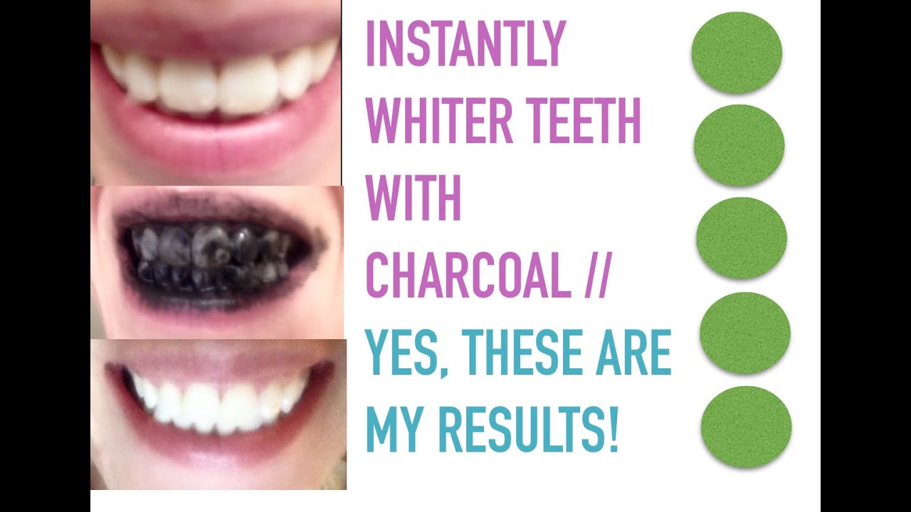 How to get instant white teeth