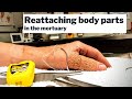 Mortuary talk - Reattaching body parts