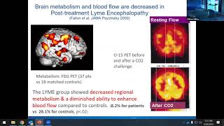 Long COVID and Long Lyme: Neuropsychiatric Implications by Brian Fallon, MD, MPH  Lyme Summit 2023