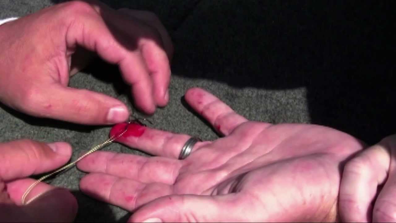 Hook Removal: Rapala® Tip 