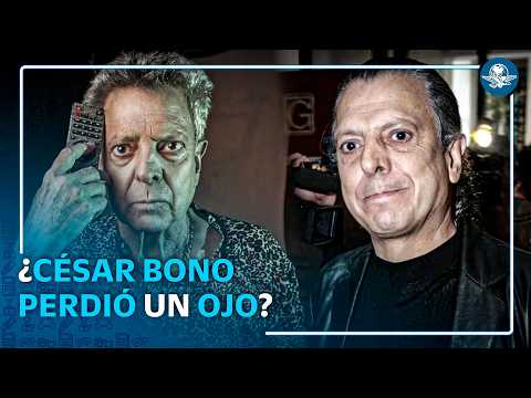 Hijo de César Bono desmiente rumores sobre la pérdida de un ojo; acusa información falsa